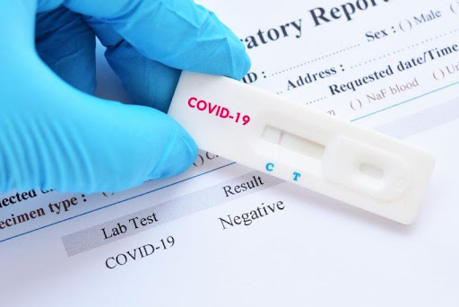Informacije o brzom antigenskom i PCR testiranju na Covid-19