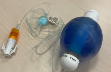 Odjel za hematologiju i onkologiju – elastomerske pumpe i primjena kemoterapije izvan bolnice